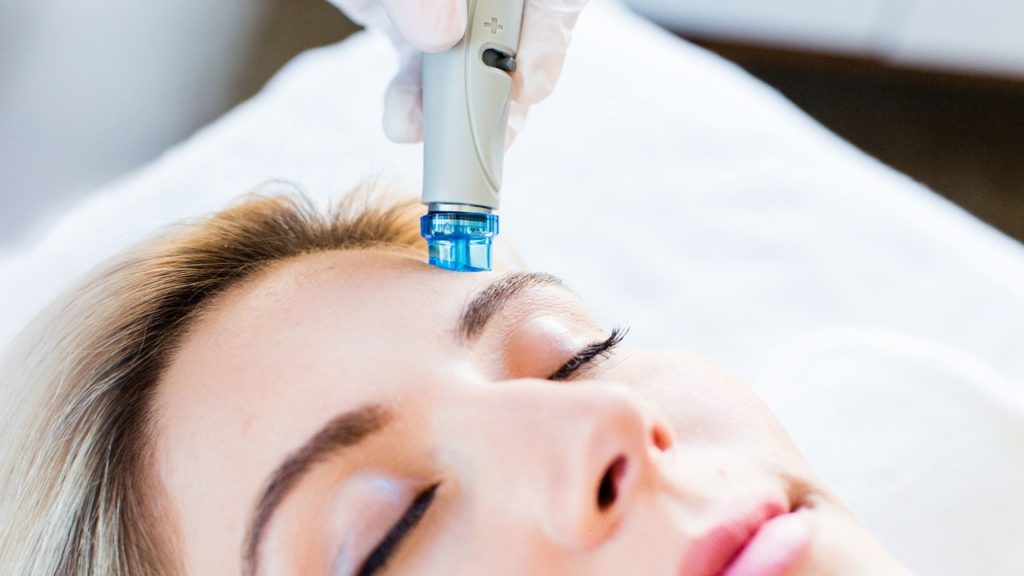 hydrafacial-treatment-for-acne